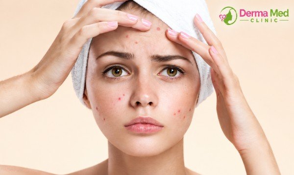 Best Skin Specialist in Chhatarpur Dr Shalini Kushwaha