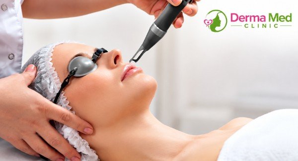 Laser Treatment in chhatarpur